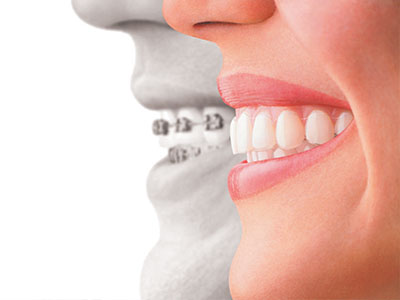 The image displays a split-screen of two individuals, one showing a healthy mouth and teeth with a radiant smile, while the other side shows an enlarged mouth with a dental implant, emphasizing the difference in oral health.