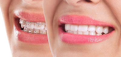 The image is a split-screen photo showing two different views of a person s smiling face, with one side displaying the full facial profile and the other focusing on the mouth area.