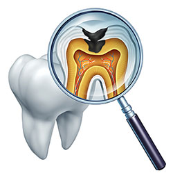 An illustration of a magnified tooth with an internal view showing the root and pulp chamber, alongside a dental mirror with a human eye reflected in it.