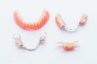 The image shows a collection of dental appliances, including braces and possibly retainers or orthodontic models, displayed on a white background.