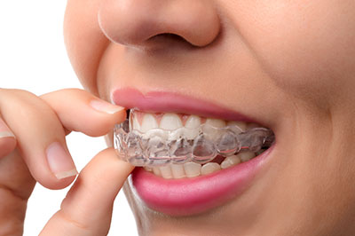 Woman with clear braces examining her teeth.