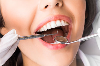 The image shows a woman with an open mouth, surrounded by dental tools, likely in a dental office setting.