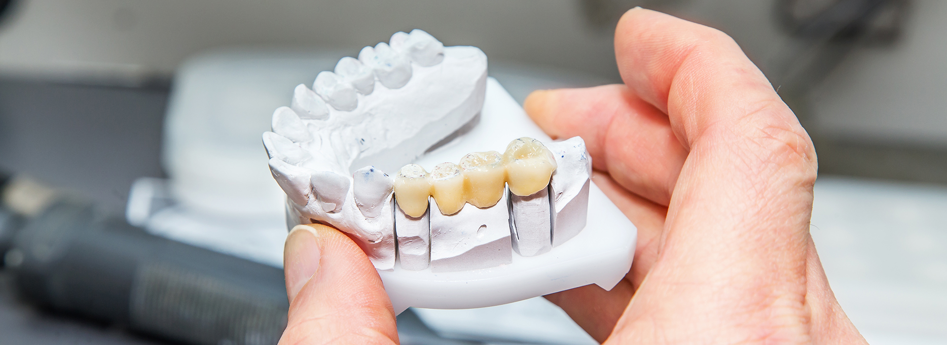 A person s hand holding a 3D printed dental implant model.