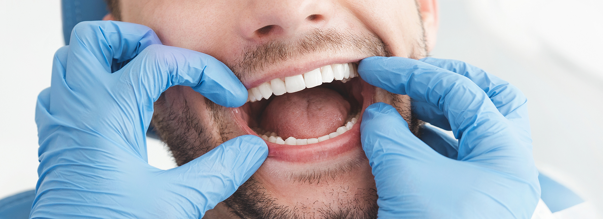 A man in a medical setting, wearing gloves and a surgical mask, is holding his mouth open with one hand while the other hand holds up a mirror to show his teeth.