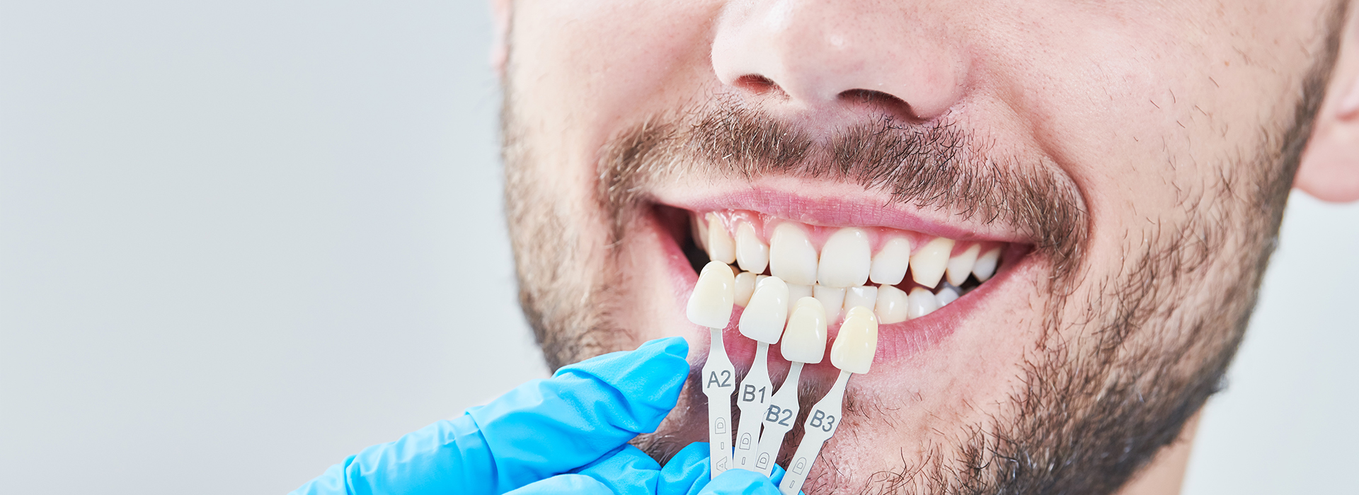 A man with a toothy smile undergoing dental treatment, with a blue surgical gown and gloves visible.