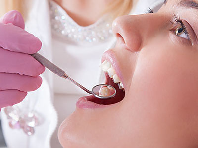 A dental professional performing a procedure on an open mouth of a patient, with the focus on the dental work being done.